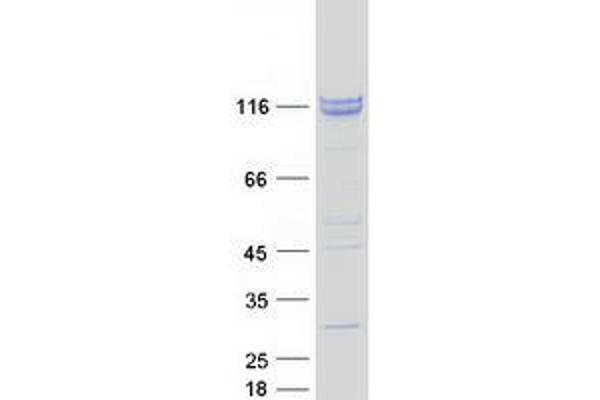 ZCCHC8 Protein (Myc-DYKDDDDK Tag)