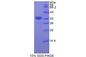 SDS-PAGE analysis of Rat BST1 Protein. (BST1 蛋白)