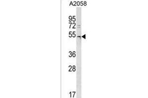 DCAF12L2 Antibody (C-term) (ABIN1537112 and ABIN2850214) western blot analysis in  cell line lysates (35 μg/lane). (DCAF12L2 抗体  (C-Term))