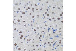 Immunohistochemistry of paraffin-embedded rat liver using MTA3 antibody (ABIN2737194) at dilution of 1:100 (40x lens). (MTA3 抗体)