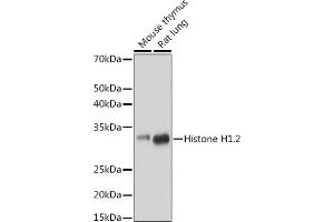 Western blot analysis of extracts of various cell lines, using Histone H1. (HIST1H1C 抗体)