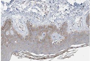 ABIN6266872 at 1/100 staining human Skin tissue sections by IHC-P. (COL14A1 抗体  (C-Term))