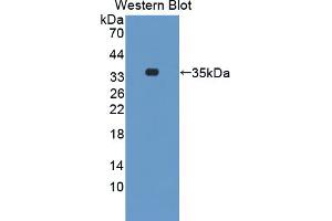 Western blot analysis of the recombinant protein. (STK3 抗体  (AA 235-460))
