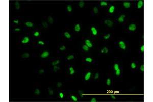 Immunofluorescence of monoclonal antibody to MEIS2 on HeLa cell. (MEIS2 抗体  (AA 1-381))