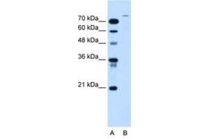 Image no. 1 for anti-Ubiquitin Specific Peptidase 48 (USP48) (AA 171-220) antibody (ABIN205064)