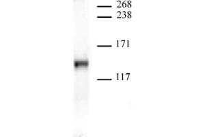 JMJD2A antibody (mAb) tested by Western blot. (KDM4A 抗体  (AA 586-674))