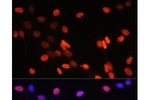 Immunofluorescence (IF) image for anti-Histone 3 (H3) (2meLys14) antibody (ABIN7261231)
