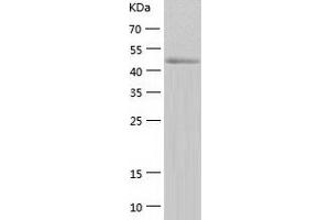 Western Blotting (WB) image for Calcium/calmodulin-Dependent Protein Kinase IV (CAMK4) (AA 1-473) protein (His tag) (ABIN7122095) (CAMK4 Protein (AA 1-473) (His tag))