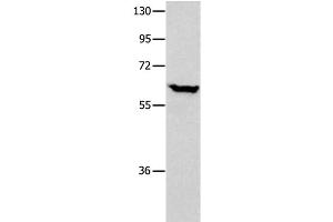 Western Blot analysis of Human seminoma tissue using DNAJC7 Polyclonal Antibody at dilution of 1:400 (DNAJC7 抗体)