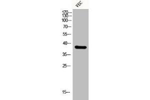 Western Blot analysis of VEC cells using EKLF/CKLF/UKLF Polyclonal Antibody (KLF1/5/7 抗体  (C-Term))