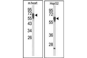 Western blot analysis of FBXL5 Antibody (N-term) Cat. (FBXL5 抗体  (N-Term))