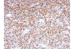 IHC-P Image Endothelin B Receptor antibody detects Ednrb protein at membrane on U87 xenograft by immunohistochemical analysis. (EDNRB 抗体  (N-Term))