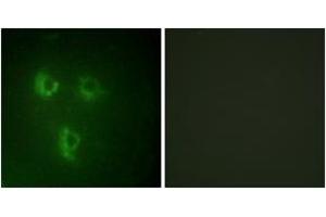 Immunofluorescence analysis of HuvEc cells, using TMEPA Antibody. (TMEPA (AA 101-150) 抗体)