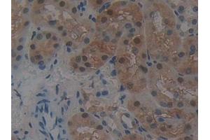 Immunohistochemistry (IHC) image for anti-Glutathione S-Transferase theta 2 (GSTT2) (AA 15-216) antibody (ABIN7432196)