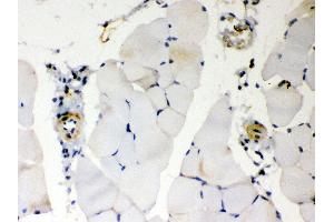 Anti- BAK Picoband antibody, IHC(P) IHC(P): Mouse Skeletal Muscle Tissue (BAK1 抗体  (AA 22-211))