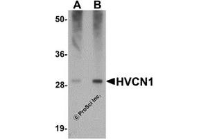 Western Blotting (WB) image for anti-Hydrogen Voltage-Gated Channel 1 (HVCN1) (C-Term) antibody (ABIN1030426) (HVCN1 抗体  (C-Term))