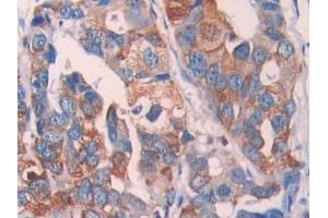 Immunohistochemistry (IHC) image for anti-Lysyl Oxidase-Like 4 (LOXL4) (AA 399-552) antibody (ABIN7437674)