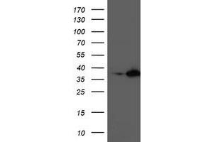 Western Blotting (WB) image for anti-Nudix (Nucleoside Diphosphate Linked Moiety X)-Type Motif 18 (NUDT18) antibody (ABIN1499860) (NUDT18 抗体)