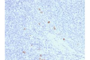 Formalin-fixed, paraffin-embedded human Tonsil stained with IgG4 Mouse Recombinant Monoclonal Antibody (rIGHG4/1345). (Recombinant IGHG4 抗体)