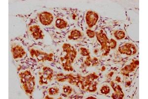 IHC image of ABIN7127361 diluted at 1:73. (Recombinant BAG3 抗体)
