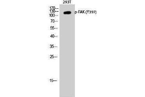 Western Blotting (WB) image for anti-PTK2 Protein tyrosine Kinase 2 (PTK2) (pTyr397) antibody (ABIN3182621) (FAK 抗体  (pTyr397))