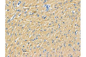 ABIN6264860 and ABIN6266755 at 1/100 staining Rat heart tissue by IHC-P. (RPS9 抗体  (Internal Region))