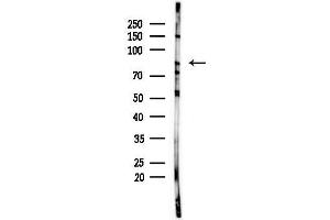 Western blot analysis of lysates from F10-LUC cells(LPS,4h treatment), using HNRNPR Antibody at 1/1000 dilution.