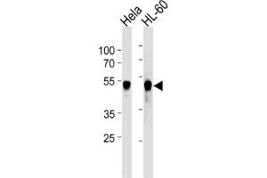 Western Blotting (WB) image for anti-Vaccinia Related Kinase 1 (VRK1) antibody (ABIN2905796) (VRK1 抗体)