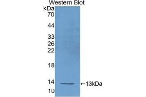 Detection of Recombinant UCP1, Mouse using Polyclonal Antibody to Uncoupling Protein 1, Mitochondrial (UCP1) (UCP1 抗体  (AA 179-296))