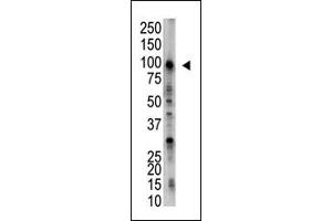 Image no. 1 for anti-Ubiquitin Specific Peptidase 5 (USP5) (C-Term) antibody (ABIN357529) (USP5 抗体  (C-Term))