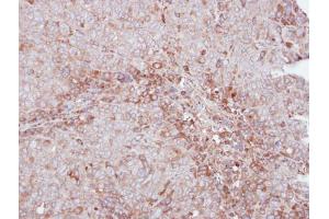 IHC-P Image Immunohistochemical analysis of paraffin-embedded DLD1 xenograft, using MMP12, antibody at 1:500 dilution. (MMP12 抗体)