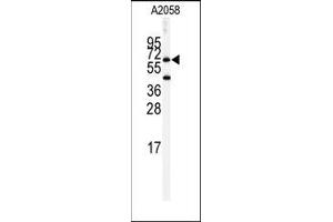 Image no. 1 for anti-Butyrylcholinesterase (BCHE) (Middle Region) antibody (ABIN360174) (Butyrylcholinesterase 抗体  (Middle Region))