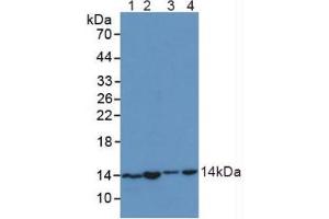 Figure. (SNRPD1 抗体  (AA 1-119))