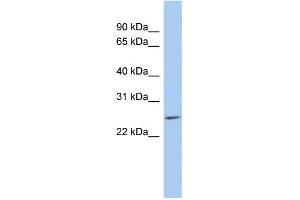 WB Suggested Anti-LYPD5 Antibody Titration: 0. (LYPD5 抗体  (N-Term))