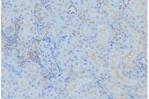 ABIN6279381 at 1/100 staining Mouse kidney tissue by IHC-P. (DYNC1H1 抗体  (Internal Region))