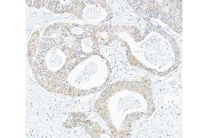 anti-KIAA1524 (KIAA1524) (AA 853-903) antibody