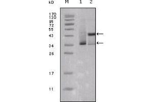 Western Blot showing ESR1 antibody used against truncated ESR1-His recombinant protein (1) and truncated Trx-ESR1 recombinant protein (2). (Estrogen Receptor alpha 抗体  (AA 301-595))