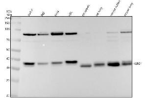 Western blot analysis of KLRG1 using anti-KLRG1 antibody (ABIN7605382).