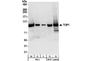 Western Blotting (WB) image for anti-Topoisomerase (DNA) I (TOP1) (AA 715-765) antibody (ABIN7450832) (Topoisomerase I 抗体  (AA 715-765))