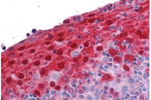 Human Tonsil: Formalin-Fixed, Paraffin-Embedded (FFPE) (S100A7 抗体  (AA 18-30))