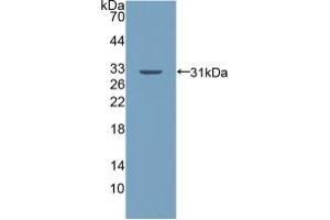 Western blot analysis of recombinant Human PALLD. (PALLD 抗体  (AA 1137-1383))
