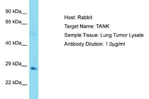 Host: Rabbit Target Name: TANK Sample Tissue: Human Lung Tumor Antibody Dilution: 1ug/ml (TANK 抗体  (N-Term))