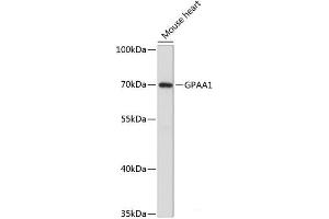 Western blot analysis of extracts of Mouse heart using GPAA1 Polyclonal Antibody at dilution of 1:3000. (GPAA1 抗体)
