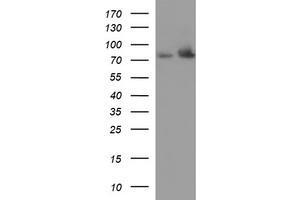 Western Blotting (WB) image for anti-Hydroxysteroid (17-Beta) Dehydrogenase 4 (HSD17B4) antibody (ABIN2715561) (HSD17B4 抗体)