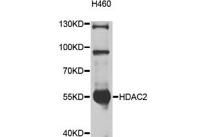 Western blot analysis of extracts of H460 cells, using HDAC2 antibody (ABIN5997878) at 1/1000 dilution. (HDAC2 抗体)