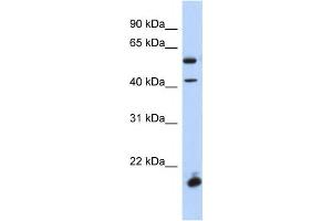 Western Blotting (WB) image for anti-Developing Brain Homeobox 1 (DBX1) antibody (ABIN2459408) (DBX1 抗体)