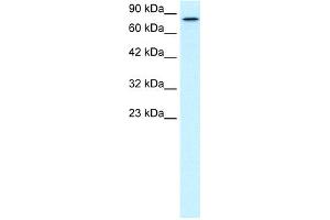 WB Suggested Anti-KIF3B Antibody Titration:  0. (KIF3B 抗体  (C-Term))