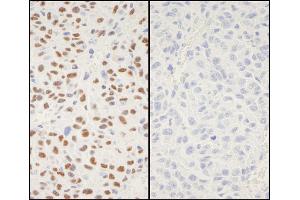 Immunohistochemistry (IHC) image for anti-X-Ray Repair Complementing Defective Repair in Chinese Hamster Cells 1 (XRCC1) (pSer518), (pThr519), (pThr523) antibody (ABIN7449037)