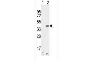 Western blot analysis of OLR1 (arrow) using rabbit polyclonal OLR1 Antibody (Center) (ABIN652795 and ABIN2842521).