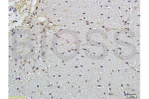 Formalin-fixed and paraffin embedded rat brain labeled with Anti-Claudin 5 Polyclonal Antibody, Unconjugated (ABIN673869) followed by conjugation to the secondary antibody and DAB staining (Claudin 5 抗体)